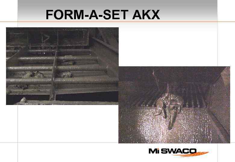 FORM-A-SET AKX 