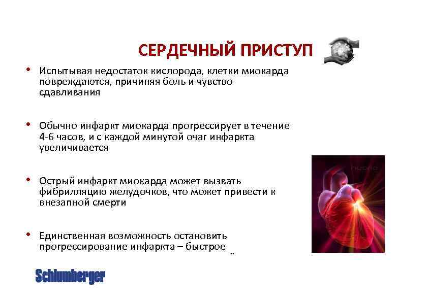 СЕРДЕЧНЫЙ ПРИСТУП • Испытывая недостаток кислорода, клетки миокарда повреждаются, причиняя боль и чувство сдавливания