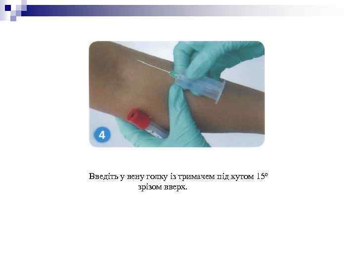 Введіть у вену голку із тримачем під кутом 15º зрізом вверх. 