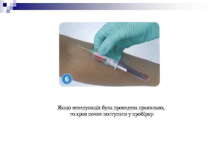Якщо венепункція була проведена правильно, то кров почне поступати у пробірку. 