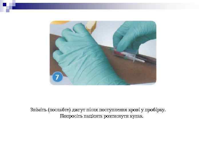 Зніміть (послабте) джгут після поступлення крові у пробірку. Попросіть пацієнта розтиснути кулак. 