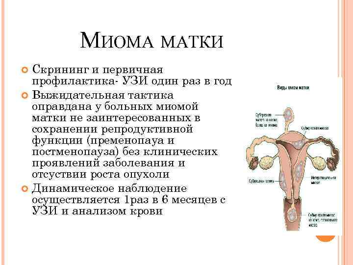  МИОМА МАТКИ Скрининг и первичная профилактика- УЗИ один раз в год Выжидательная тактика