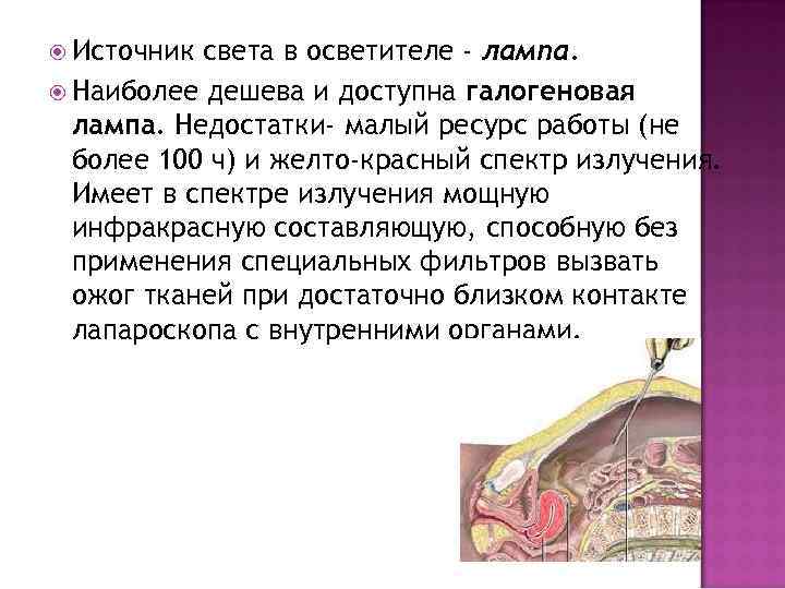  Источник света в осветителе - лампа. Наиболее дешева и доступна галогеновая лампа. Недостатки-