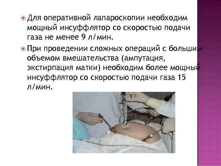 Для оперативной лапароскопии необходим мощный инсуффлятор со скоростью подачи газа не менее 9