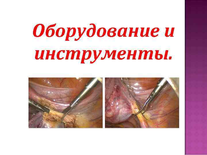 Оборудование и инструменты. 