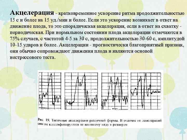 Акцелерация - кратковременное ускорение ритма продолжительностью 15 с и более на 15 уд. /мин