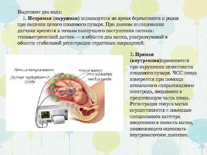 Выделяют два вида: 1. Непрямая (наружная) используется во время беременноти и родов при наличии