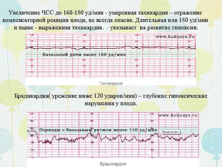 Сердцебиение плода норма