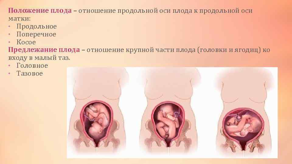 Положение плода – отношение продольной оси плода к продольной оси матки: • Продольное •