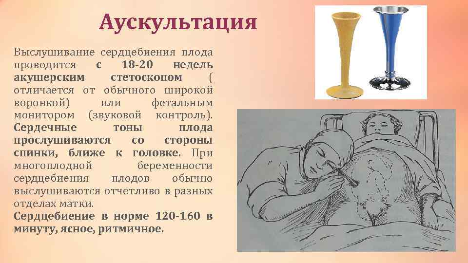 Аускультация Выслушивание сердцебиения плода проводится с 18 -20 недель акушерским стетоскопом ( отличается от