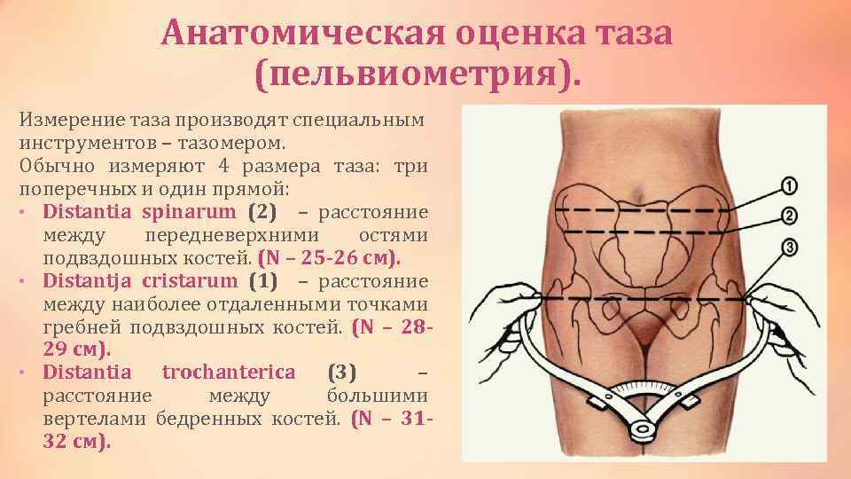 Наиболее частая форма