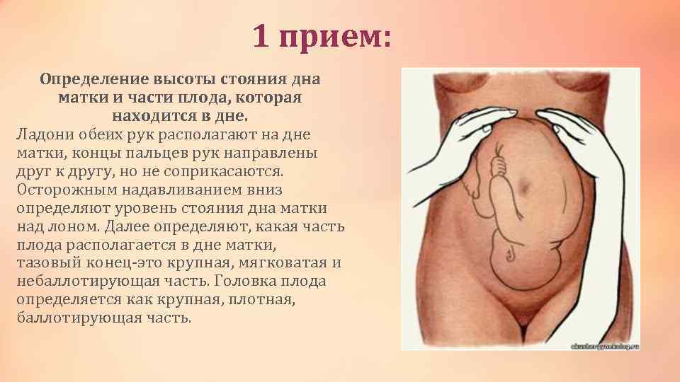 1 прием: Определение высоты стояния дна матки и части плода, которая находится в дне.