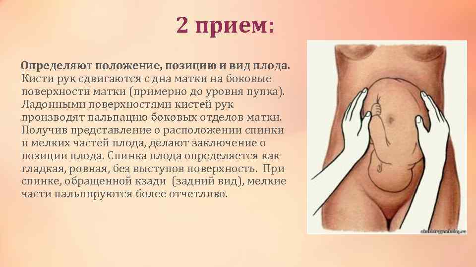 2 прием: Определяют положение, позицию и вид плода. Кисти рук сдвигаются с дна матки