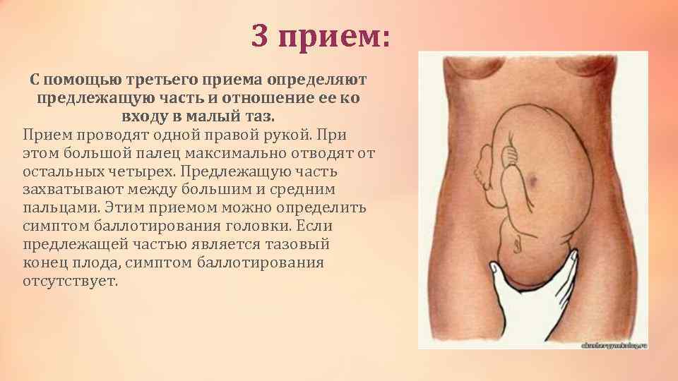 3 прием: С помощью третьего приема определяют предлежащую часть и отношение ее ко входу