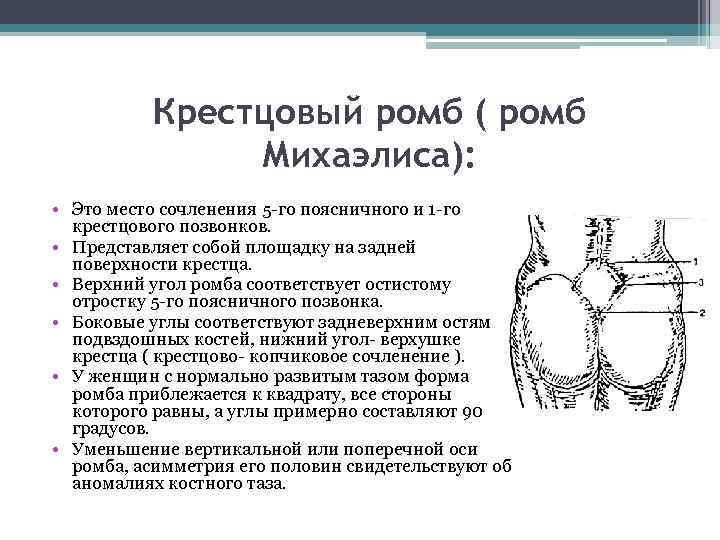 Крестцовый ромб ( ромб Михаэлиса): • Это место сочленения 5 -го поясничного и 1