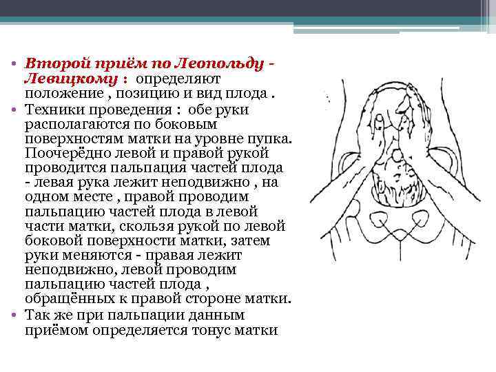  • Второй приём по Леопольду Левицкому : определяют положение , позицию и вид