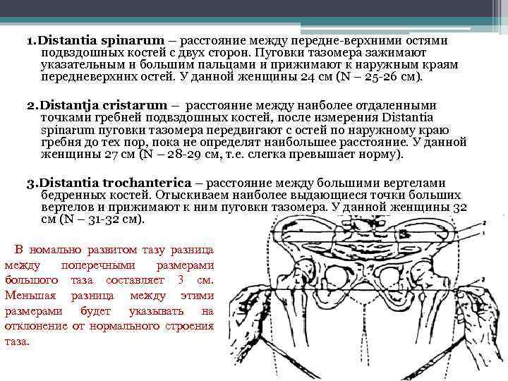 1. Distantia spinarum – расстояние между передне-верхними остями подвздошных костей с двух сторон. Пуговки