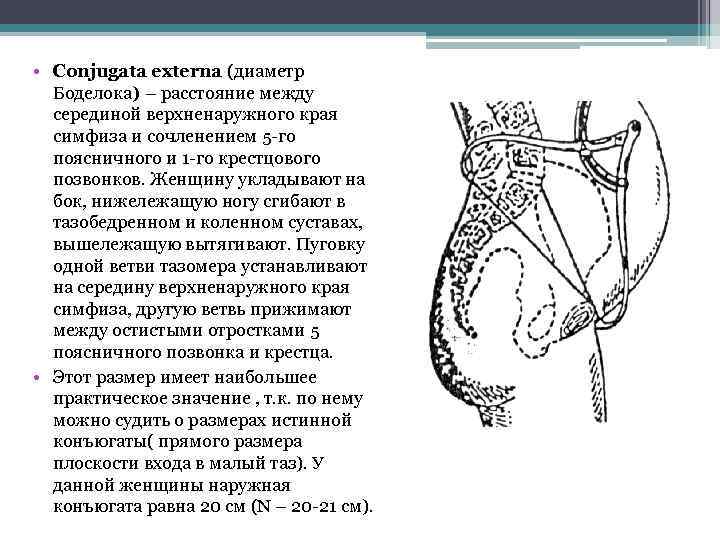  • Сonjugata externa (диаметр Боделока) – расстояние между серединой верхненаружного края симфиза и