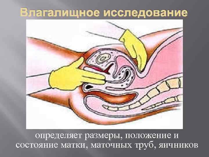 Влагалищное исследование. Бимануальное влагалищное исследование исследование. Бимануальное исследование шейки матки. Влагалищное исследование проводят с целью. Влагалищное исследование при беременности.