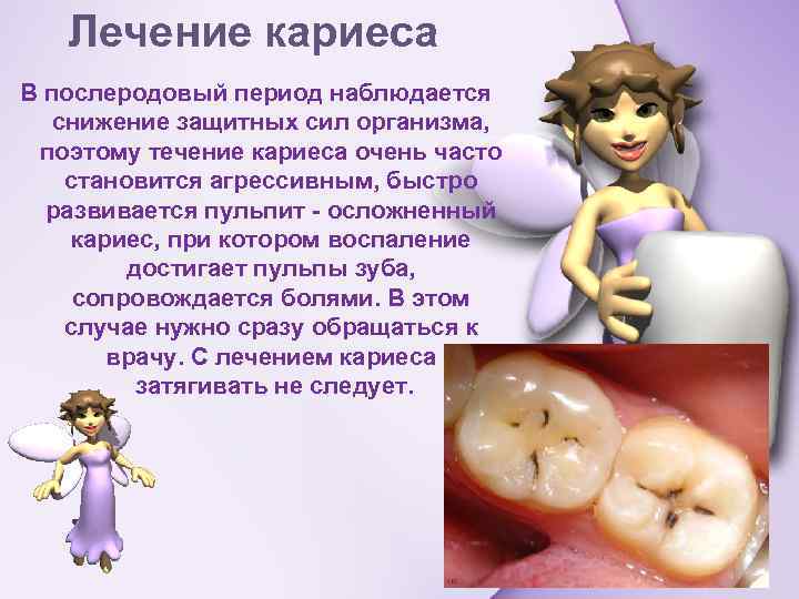 Лечение кариеса В послеродовый период наблюдается снижение защитных сил организма, поэтому течение кариеса очень