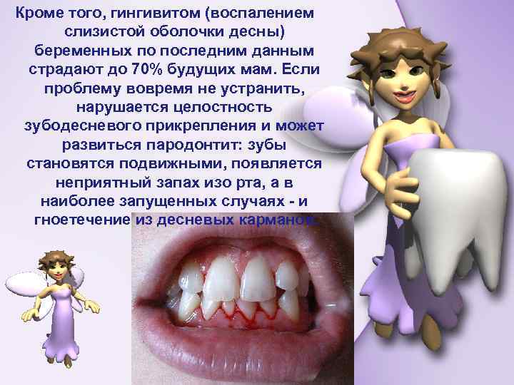 Кроме того, гингивитом (воспалением слизистой оболочки десны) беременных по последним данным страдают до 70%