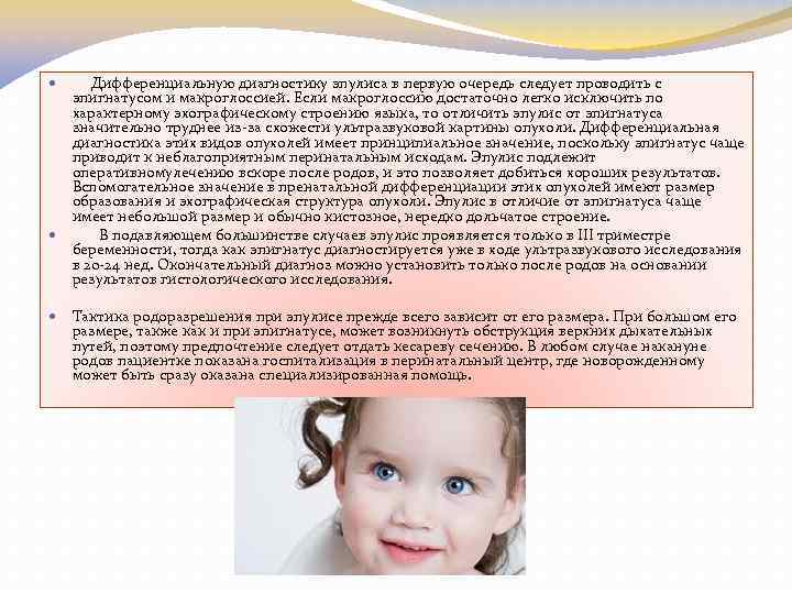  Дифференциальную диагностику эпулиса в первую очередь следует проводить с эпигнатусом и макроглоссией. Если