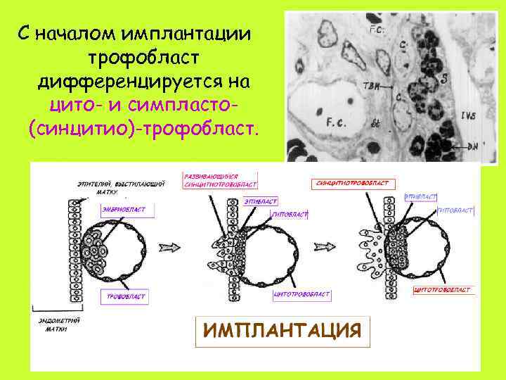 Имплантация начинается