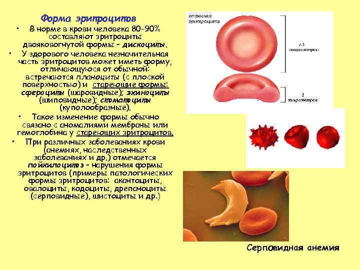  • Форма эритроцитов В норме в крови человека 80 -90% составляют эритроциты двояковогнутой