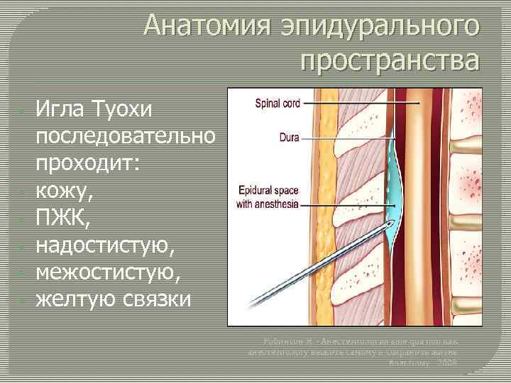 Анатомия эпидурального пространства • • • Игла Туохи последовательно проходит: кожу, ПЖК, надостистую, межостистую,