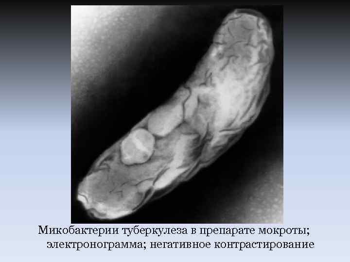 Микобактерии туберкулеза в препарате мокроты; электронограмма; негативное контрастирование 