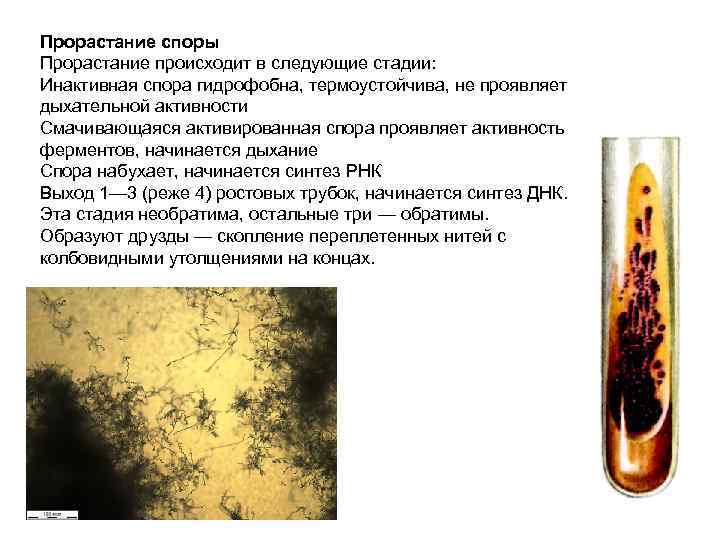 Прорастание споры Прорастание происходит в следующие стадии: Инактивная спора гидрофобна, термоустойчива, не проявляет дыхательной