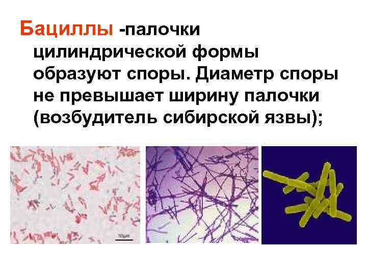 Бациллы -палочки цилиндрической формы образуют споры. Диаметр споры не превышает ширину палочки (возбудитель сибирской