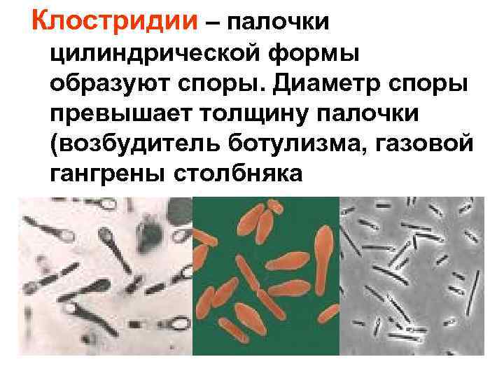 Микроорганизмы образующие споры