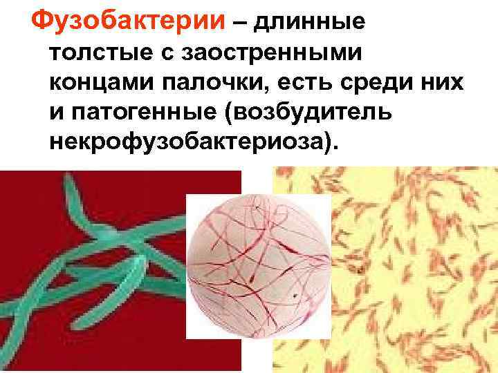 Фузобактерии – длинные толстые с заостренными концами палочки, есть среди них и патогенные (возбудитель
