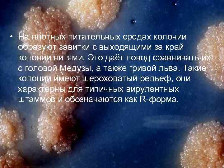  • На плотных питательных средах колонии образуют завитки с выходящими за край колонии