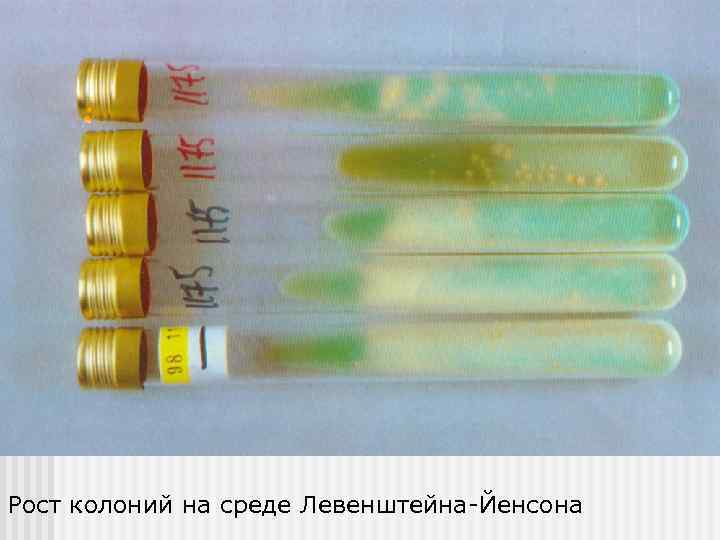 Рост колоний на среде Левенштейна-Йенсона 