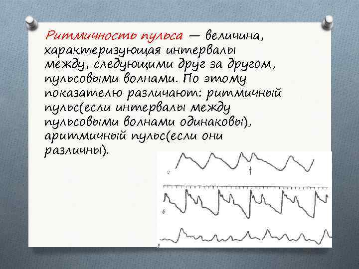 Ритмичность пульса — величина, характеризующая интервалы между, следующими друг за другом, пульсовыми волнами. По