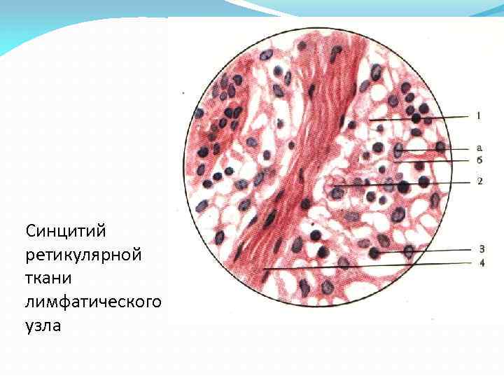 Синцитий ретикулярной ткани лимфатического узла 