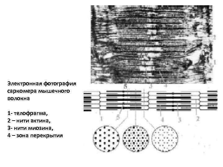 Электронная фотография саркомера мышечного волокна 1 - телофрагма, 2 – нити актина, 3 -