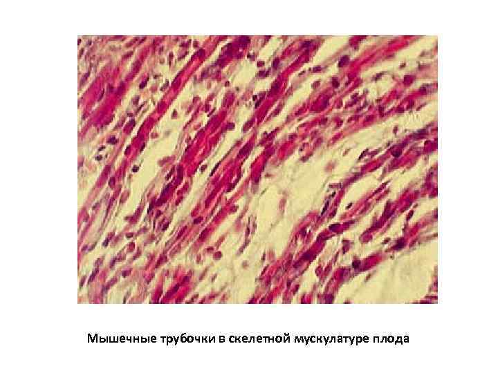 Мышечные трубочки в скелетной мускулатуре плода 