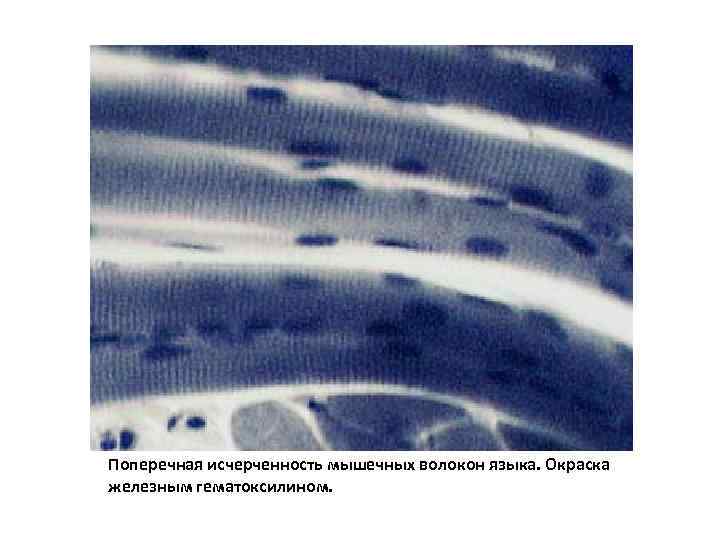 Поперечная исчерченность мышечных волокон языка. Окраска железным гематоксилином. 
