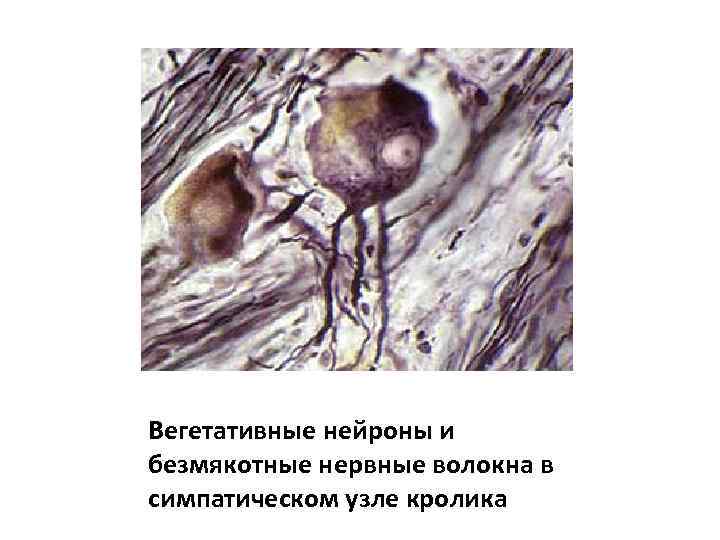 Вегетативные нейроны и безмякотные нервные волокна в симпатическом узле кролика 