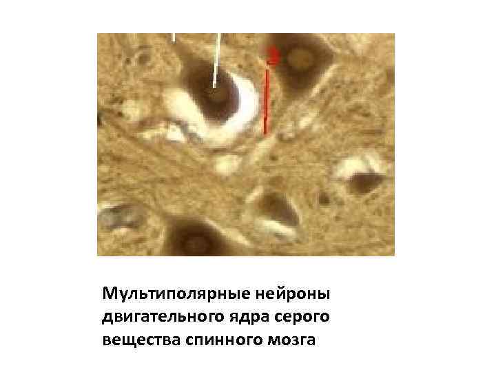 Мультиполярные нейроны двигательного ядра серого вещества спинного мозга 