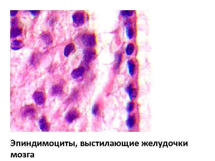 Эпиндимоциты, выстилающие желудочки мозга 