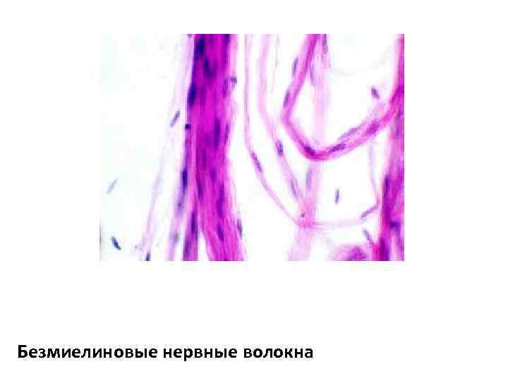 Безмиелиновые нервные волокна 