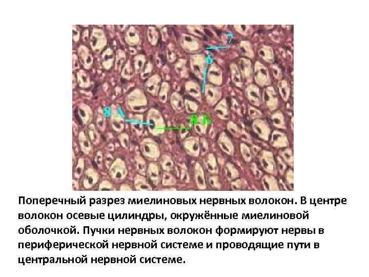 Поперечный разрез миелиновых нервных волокон. В центре волокон осевые цилиндры, окружённые миелиновой оболочкой. Пучки