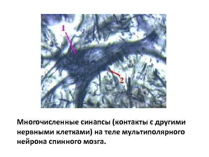 Многочисленные синапсы (контакты с другими нервными клетками) на теле мультиполярного нейрона спинного мозга. 