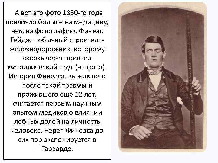  А вот это фото 1850 -го года повлияло больше на медицину, чем на