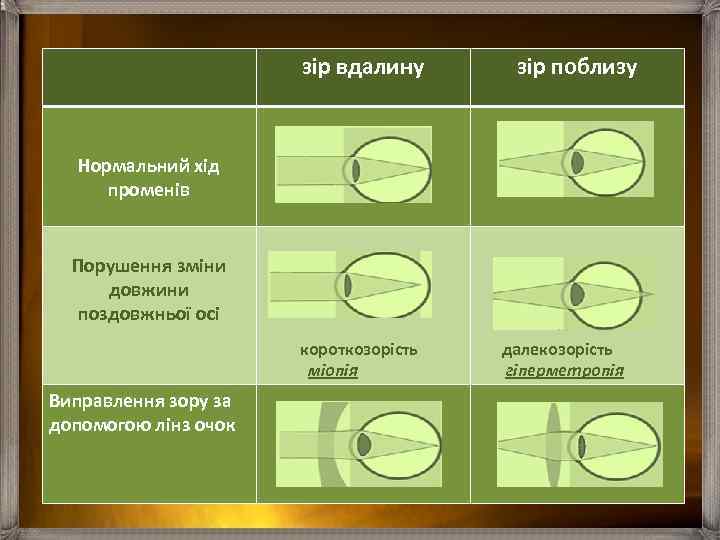 зір вдалину зір поблизу Нормальний хід променів Порушення зміни довжини поздовжньої осі Виправлення зору