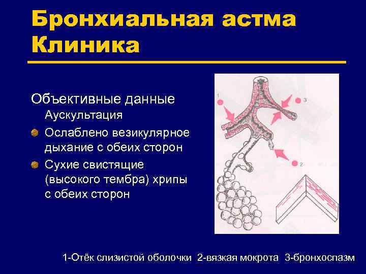 Бронхиальная астма Клиника Объективные данные Аускультация Ослаблено везикулярное дыхание с обеих сторон Сухие свистящие